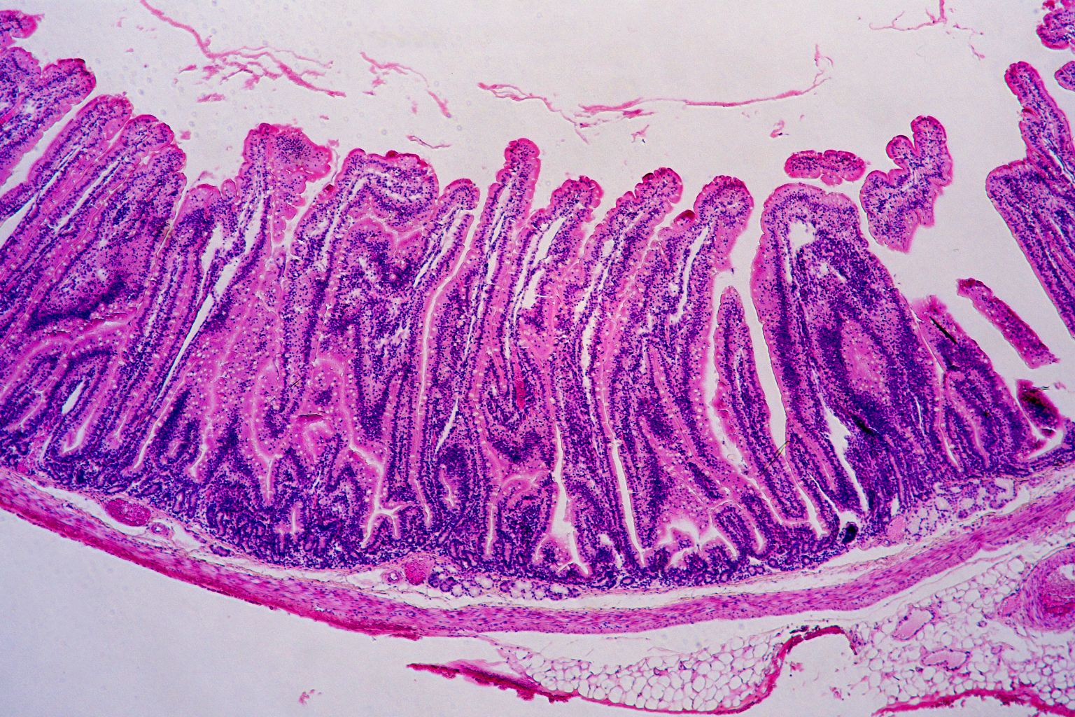 Leaky Gut – Was steckt wirklich hinter dem „durchlässigen Darm“?