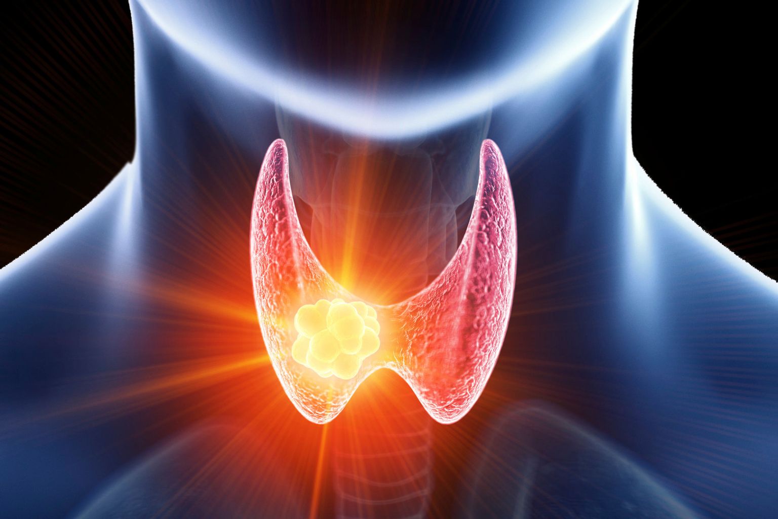 Hypothyreose: Symptome, Ursachen und Therapie