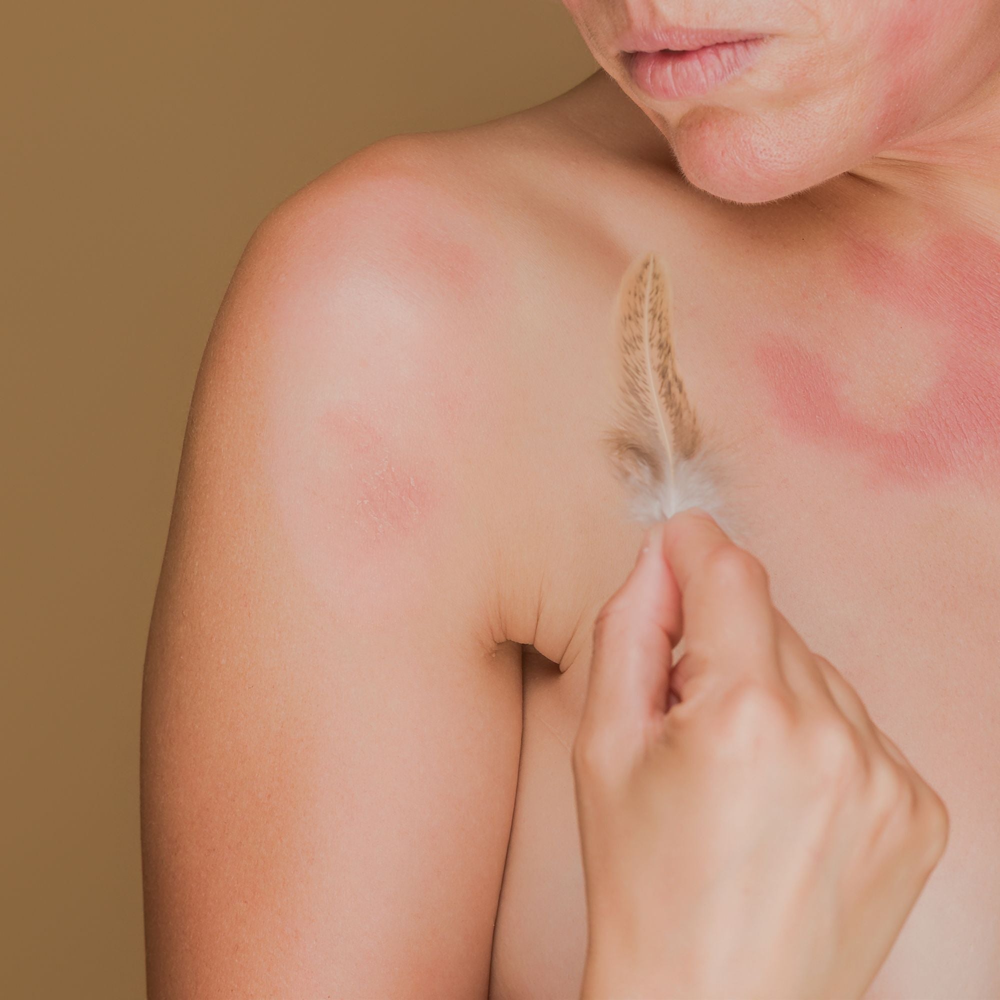 Wenn die Sonne zur Belastung wird – was hinter einer Sonnenallergie steckt