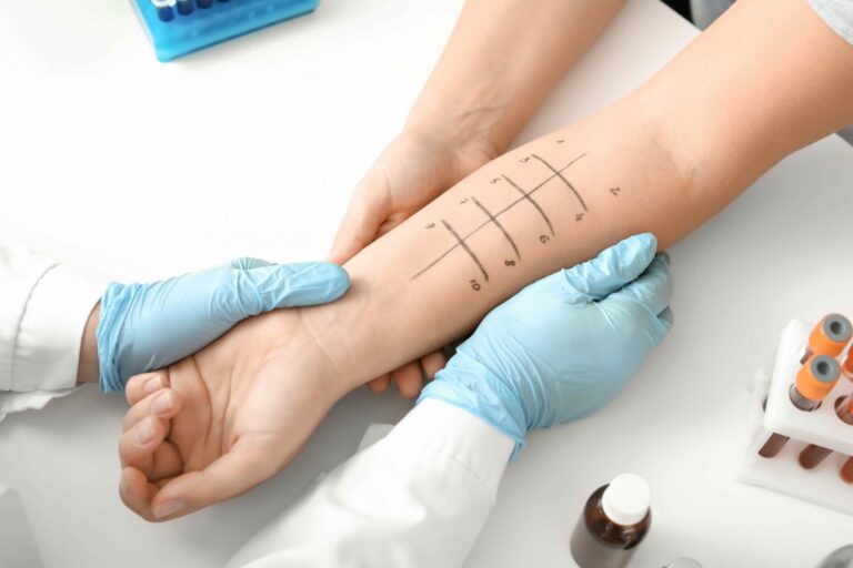 Allergy test